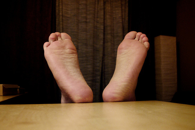 Plantar Fasciitis Plantar Fasciitis