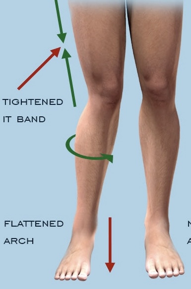 Knee Pain & Posture Post Thumbnail