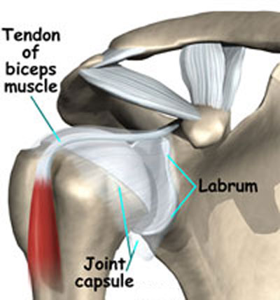 Post Surgical Rehabilitation of the Shoulder (Labral Tear) Part 1 Post Thumbnail
