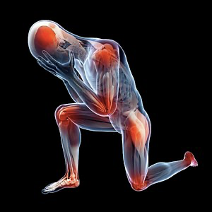 Stiffness Hides a Stability Problem and Causes a Mobility Issue Post Thumbnail